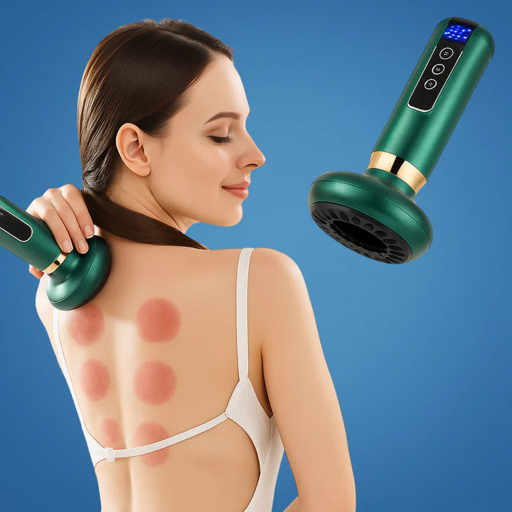 Heated Electric Cupping Massager with Adjustable Suction